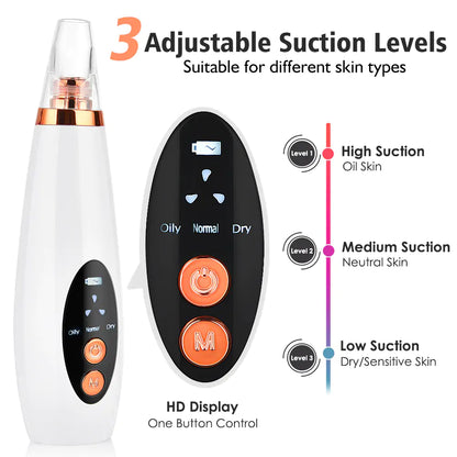 Electric Blackhead Remover